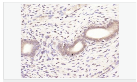 60584b88e2139.png image.png