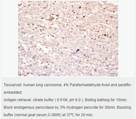 60594b6dbcc8a.png image.png