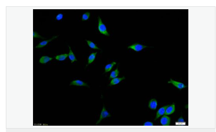 605da1b7e2d44.png image.png