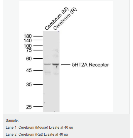 606571d5a5737.png image.png